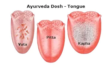 Ayurvedic Pulse & Tongue Diagnosis