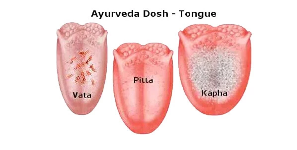 Ayurvedic Pulse & Tongue Diagnosis